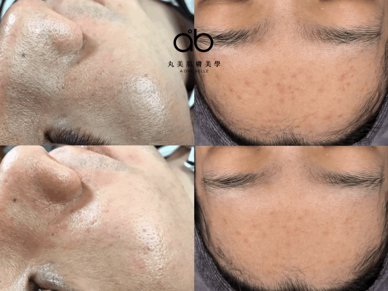 海藻針-藻針-課程回饋