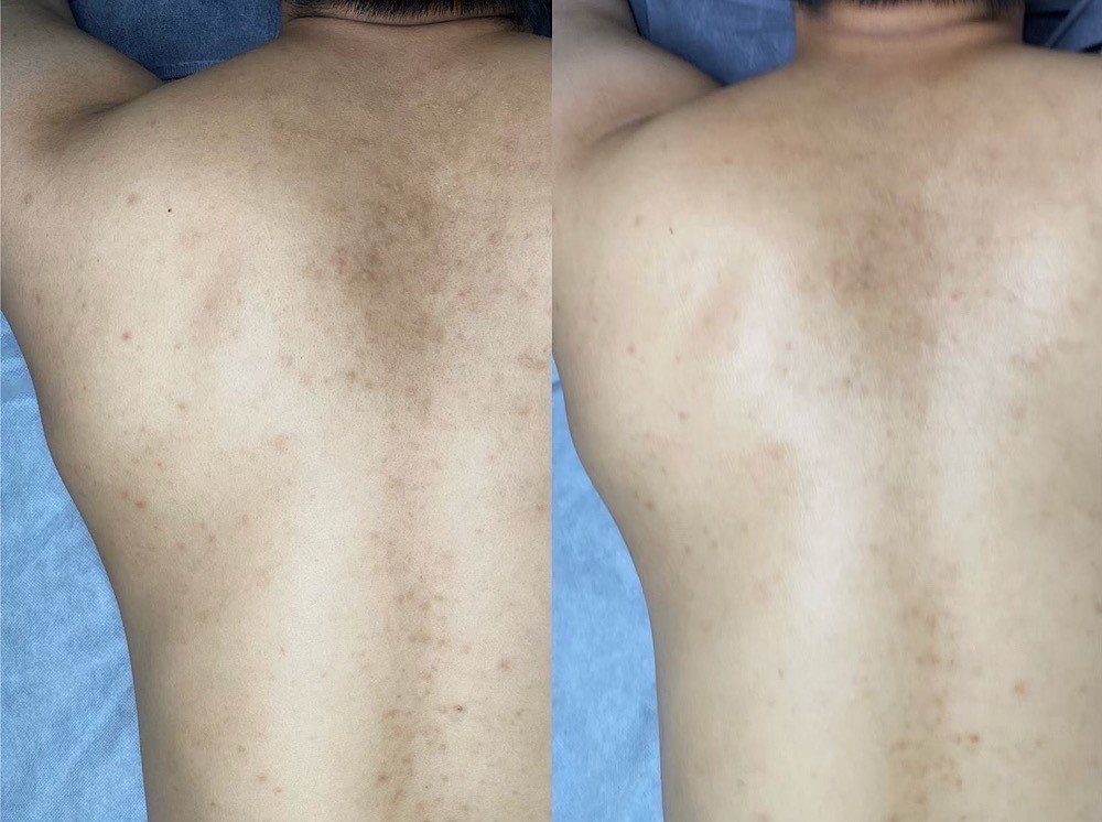 身體-五方酸淨透課程